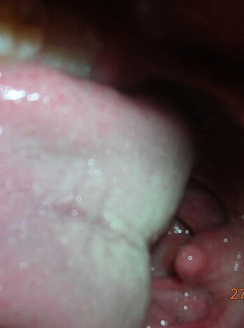 "Check out this fucking close-up of someone's diseased gob with their swollen tongue and infected fucking tonsils, motherfucker."