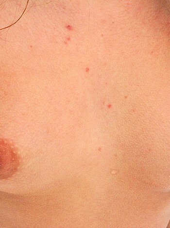 Nude In Public (set) 82  - Photo 55
