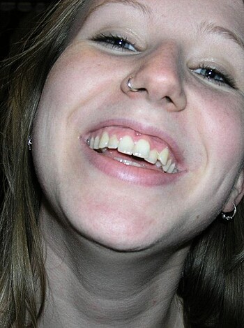 Vulgar description: A smirking bitch with a gap-toothed grin and a shiny schnozola stares at the camera.