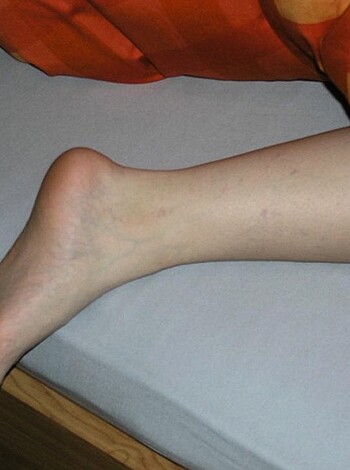 "A clear shot of someone's foot, with the toes and ankle twisted awkwardly."