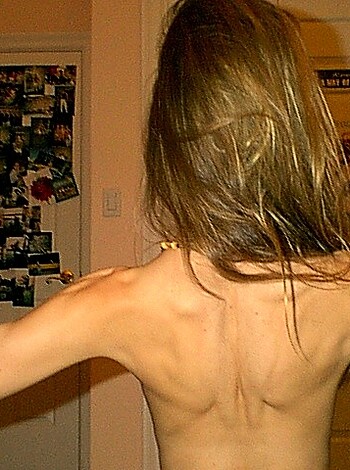 Blonde Skinny Nude Babe big set - Photo 29
