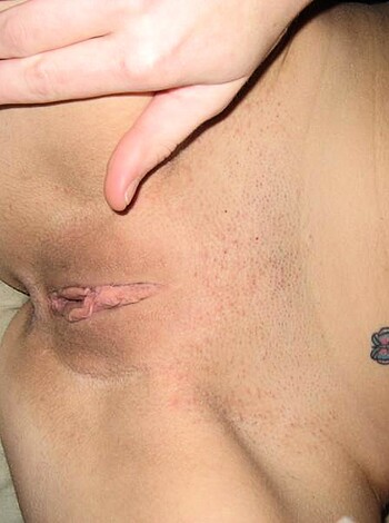 """
This image shows a woman’s vagina with an obvious scar running down the middle. Her bush is fully grown out, exposing her cooch in all its glory. 
"""