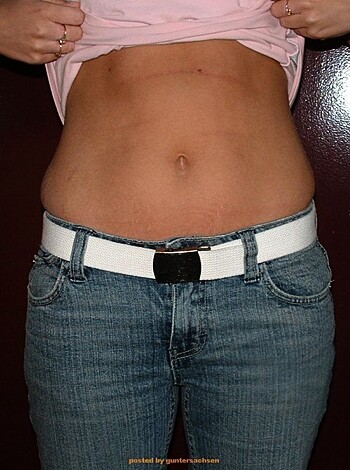 Teen Girlfriend posing Naked - Photo 49