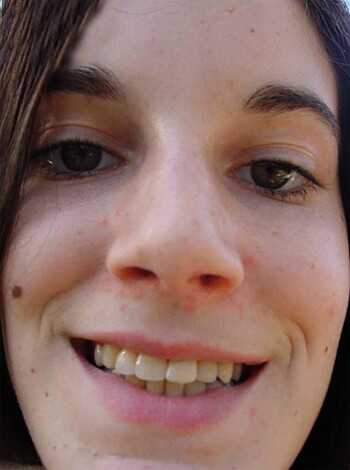 Horny Amateur Teen 12 - Photo 36