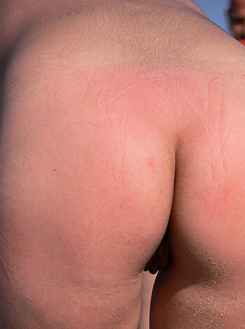 "This image shows a hot bitch's ass, covered in red welts and scratches from a recent whoopin'."