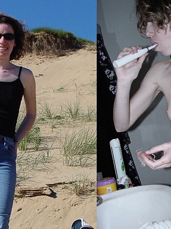Vulgar description: "Here's a naked bitch with no teeth brushing her fucking choppers outside."