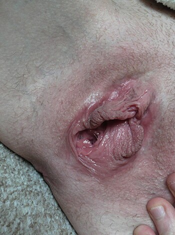 Fucking ass hole got hurt down there, look at that shit.