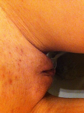 "Check out this fuckin' dick pic - it's got all kinds of shit on the skin down there."