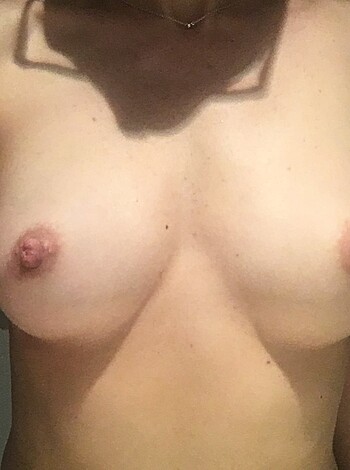 Fuckin hell, check out this picture of some fuckin bitch with her tits hangin' out like some kinda fuckin' fruit salad.