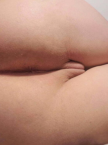 "Vulgar description: A hairy asshole and naked ass on display."