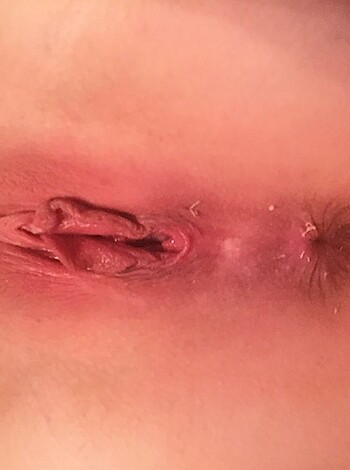 "
Fucking look at that fucking vaginal mess!
Its piss-filled, blood-soaked, and stinking up the place.
Gross!"