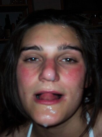 "Here's an image of a bitch with a swollen tongue, slathering saliva all over her freckled tits. Her skin's fucked up with red spots that look like hives or something."