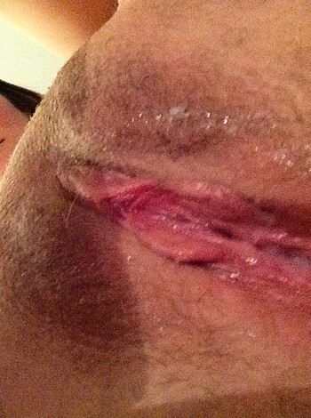Fucking hell! This is an image of a guy's ass cheeks, all fucked up and bleeding like he got the shit beat outta him. Shot musta hurt like a motherfucker too.